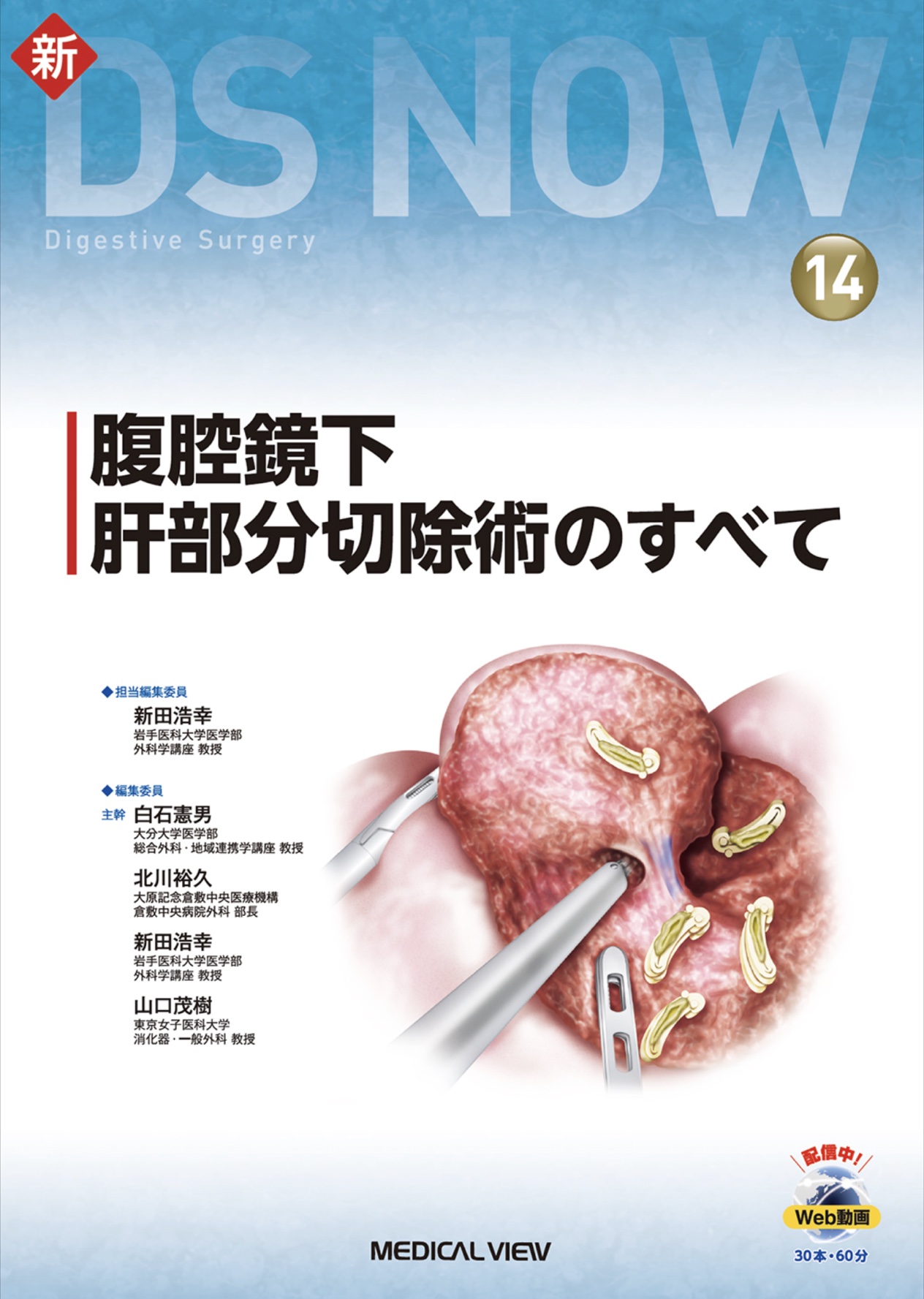 新DS NOW 14 腹腔鏡下肝部分切除術のすべて・分担執筆のお知らせ 